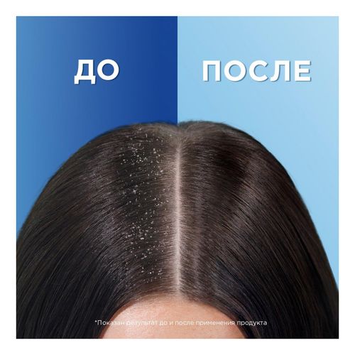 Шампунь Head & Shoulders Глубокое увлажнение против перхоти с кокосовым маслом для сухих волос 400 мл